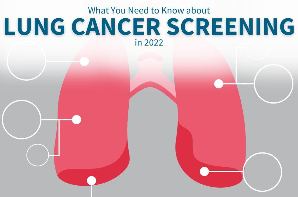 What You Need to Know about Lung Cancer Screening in 2022